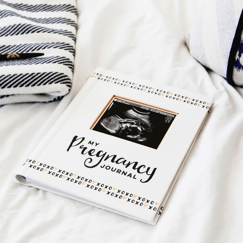 Pearhead Pregnancy Journal - Black/White/Gold