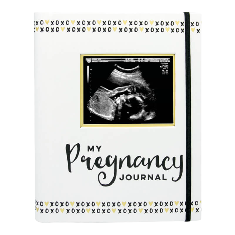 Pearhead Pregnancy Journal - Black/White/Gold